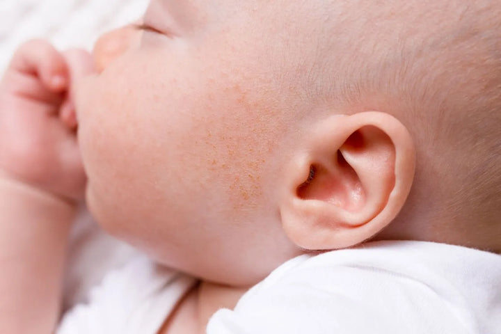 La dermatite atopique est une maladie de peau courante chez le bébé et l'enfant. Pour soulager et traiter, des traitements naturels existent pour la dermatite atopique.
