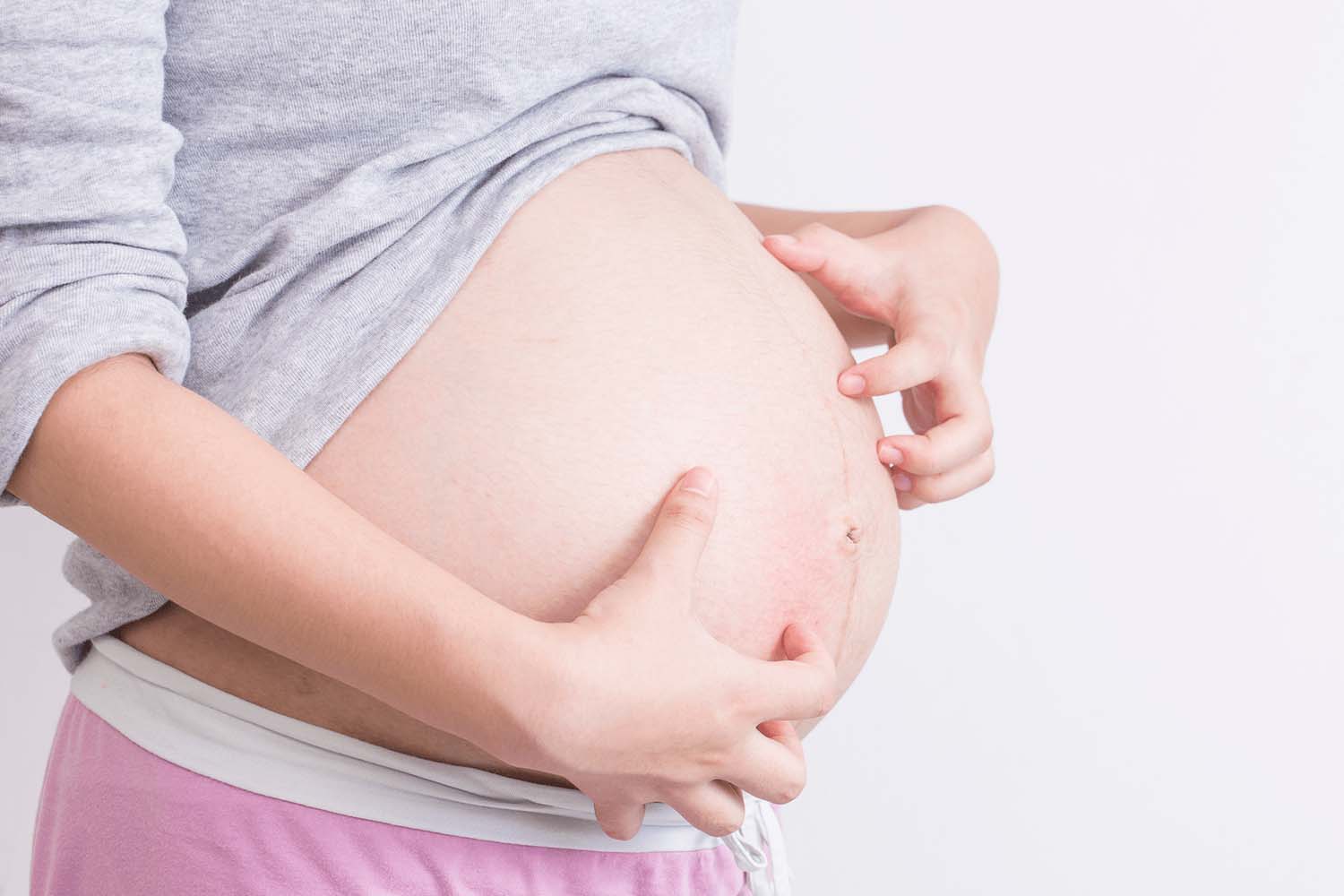 Les démangeaisons de grossesse - Laboratoires Téane