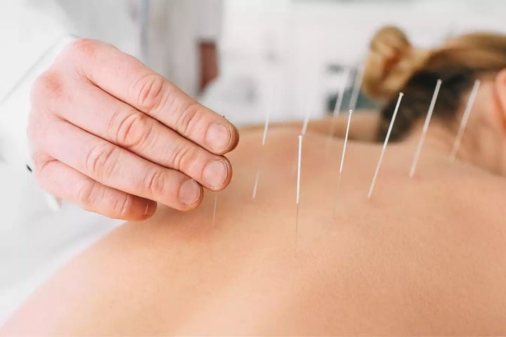 acupuncture grossesse
