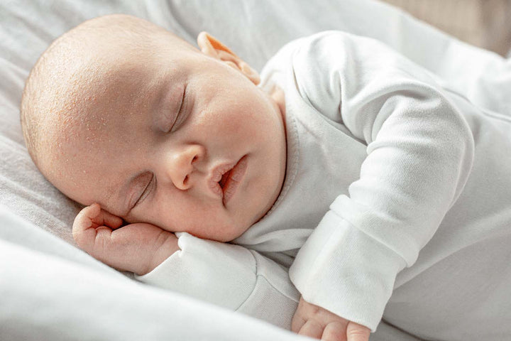 croûtes de lait bébé